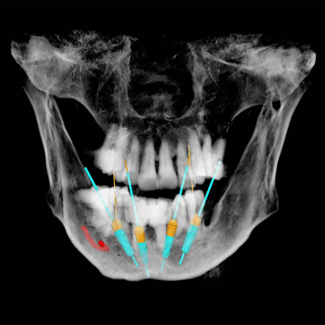 Radiology Interpretations